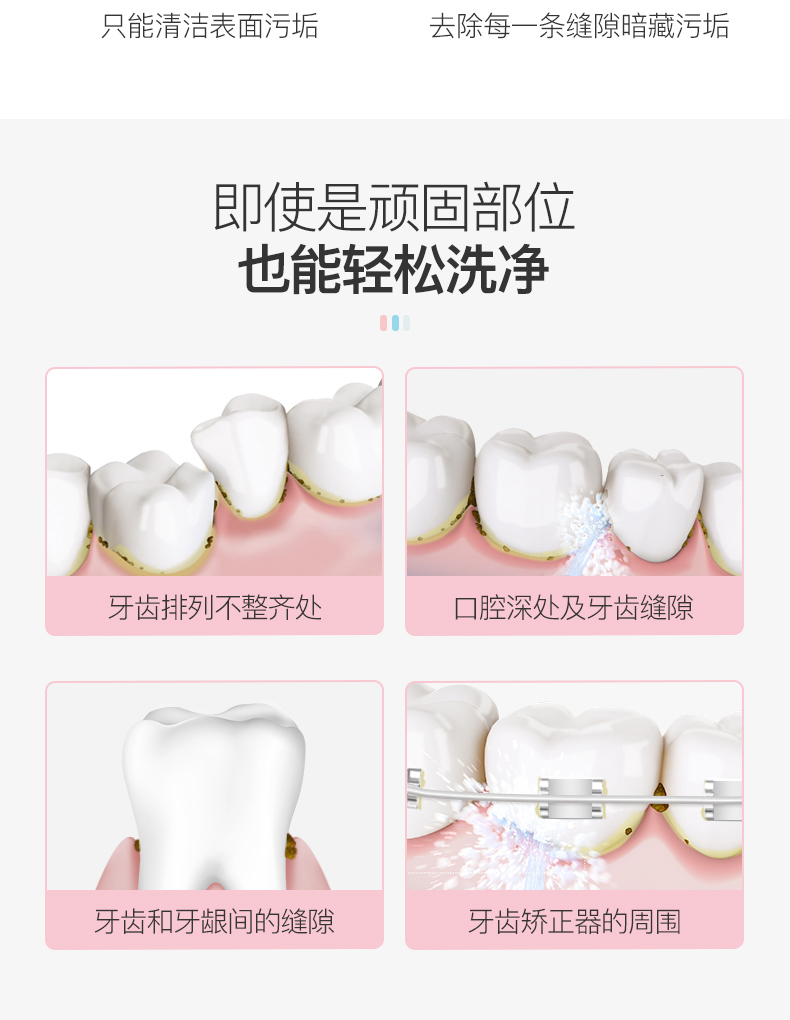 九游官网登陆迷你型洗牙器